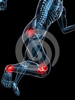 Running skeleton - painful knee and hip