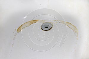 Rust in the bathroom