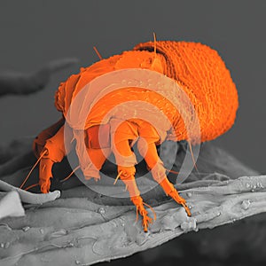 Rust mite observed in a scanning electron microscope