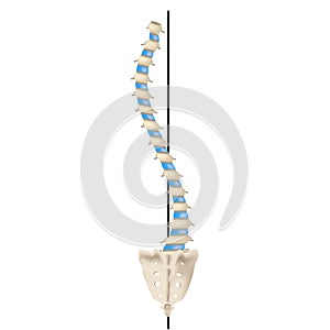 S-shaped scoliosis. Dextroscoliosis. Levoscoliosis. Spinal curvature, kyphosis, lordosis, scoliosis, arthrosis