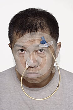 Sad Chinese man with nasogastric tube portrait