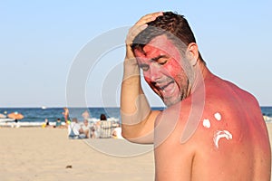 Sad face over sunburned skin photo