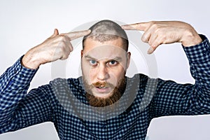 Sad guy with alopecia on head, touching hair and looks in the mirror. Spot Baldness, Hair fall problem