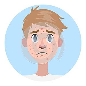 Sad man with acne on the face