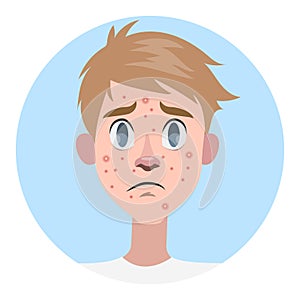 Sad man with acne on the face photo