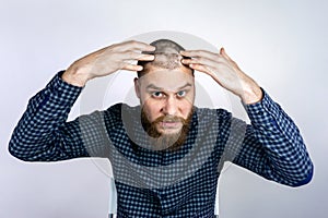 Sad Man with alopecia on head, touching hair and looks in the mirror. Spot Baldness, Hair fall problem