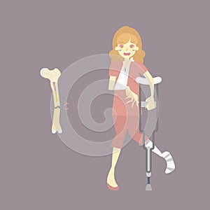 sad patient with cast on broken leg and arm bone holding crutch, walking aid, body part orthopedic healthcare, fracture concept