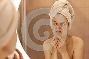 Sad unhappy young adult woman wearing bath towel squeezing acne on chin, mirror reflection of female with pimples on her face,