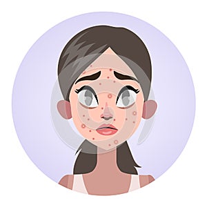 Sad woman with acne on the face photo