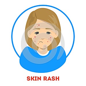 Sad woman suffering from a skin rash. Acne