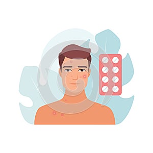 Sad worried man with red pimples on face and pills for acne treatment