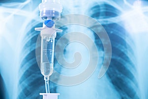 Saline drip medical,IV Drip Solution, Intravenous Treatment for Hospital Patients,coronavirus or covid-19 concept,Lung X-ray Film