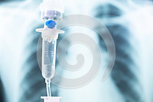 Saline drip medical,IV Drip Solution, Intravenous Treatment for Hospital Patients,coronavirus or covid-19 concept,Lung X-ray Film