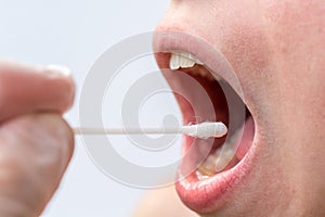 Saliva test on the mouth with cotton swabs as a test for various diseases