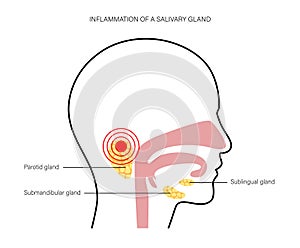 Salivary gland concept