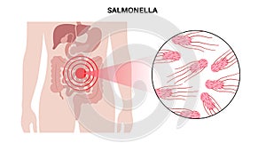 .Salmonella Typhimurium Cells photo