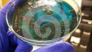 Salmonella black colonies and Pseudomonas on Chromogenic Agar