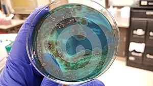 Salmonella black colonies and Pseudomonas on Chromogenic Agar