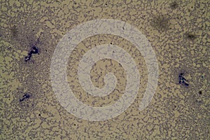 Salmonella pathogen 200x photo