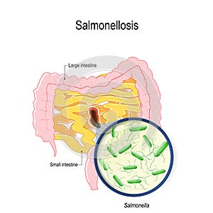 Salmonellosis. human intestines and bacterium that cause this disease
