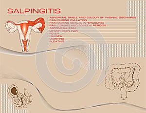 Salpingitis background
