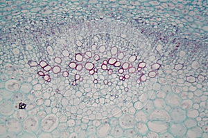 Sambucus stem with parenchyma cells under the microscope