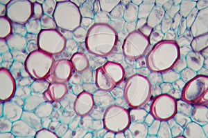 Sambucus stem with parenchyma cells under the microscope photo