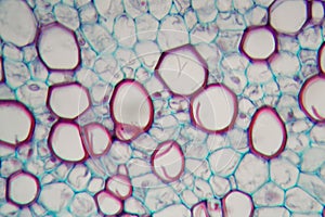 Sambucus stem with parenchyma cells under the microscope photo