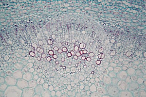 Sambucus stem with parenchyma cells under the microscope photo