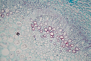 Sambucus stem with parenchyma cells under the microscope photo