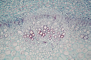 Sambucus stem with parenchyma cells under the microscope photo