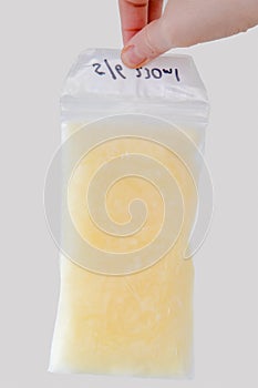 Sample of frozen expressed human breast milk in a plastic sachet.