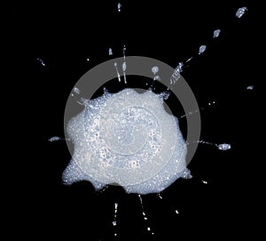 Sample of human spit or saliva on black background as concept for coronavirus test photo