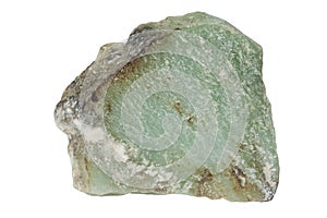 Sample of the nephritis