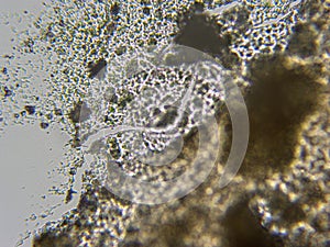 Shower curtain skum in microscope photo