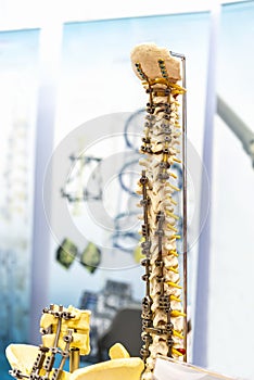 Sample structure show spine bone and hip bone with metal fixation set on table