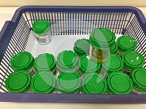 Sample urin on container in laboratory