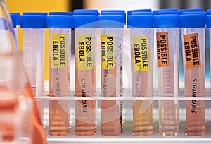 Sample vials of possible Ebola patients infected with new Zaire strain of Ebola