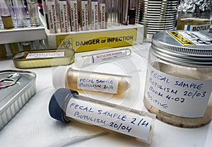 Samples contaminated by Clostridium botulinum toxin that causes botulism in humans, laboratory research