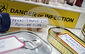 Samples contaminated by Clostridium botulinum toxin that causes botulism in humans, laboratory research