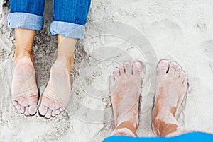 Sandy female and male feet on the beach