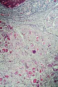 Sarcocystis spore animals in muscle