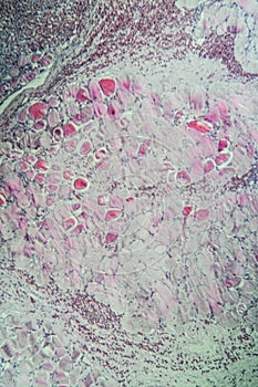 Sarcocystis spore animals in muscle