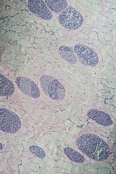 Sarcocystis spore animals in muscle