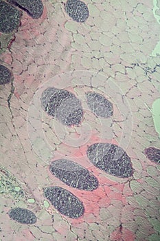 Sarcocystis spore animals in muscle