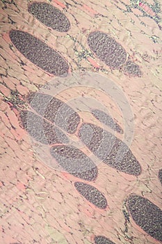 Sarcocystis spore animals in muscle