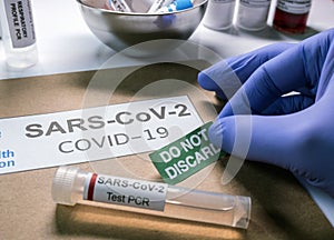 SarsCov2 coronavirus pcr vial together with a dossier folder indicating not to be discarded