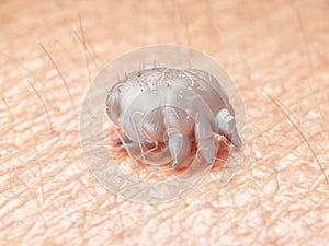 A scabies mite