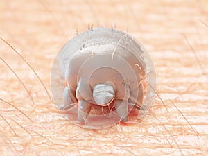A scabies mite photo