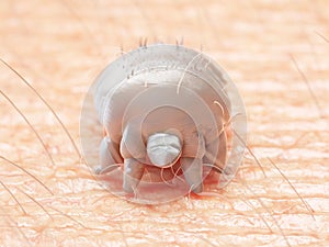 A scabies mite
